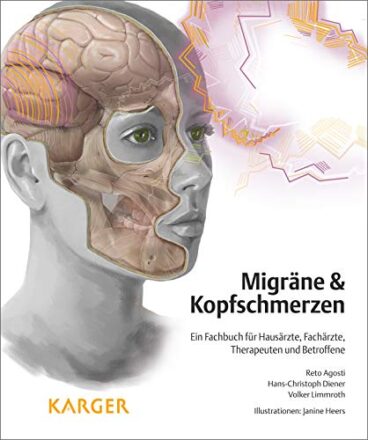 Migräne und Kopfschmerzen: Ein Fachbuch für Hausärzte, Fachärzte, Therapeuten und Betroffene - Illustrationen: J. Heers  